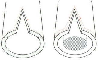 Solid state HF welder is a typical example of induction heating